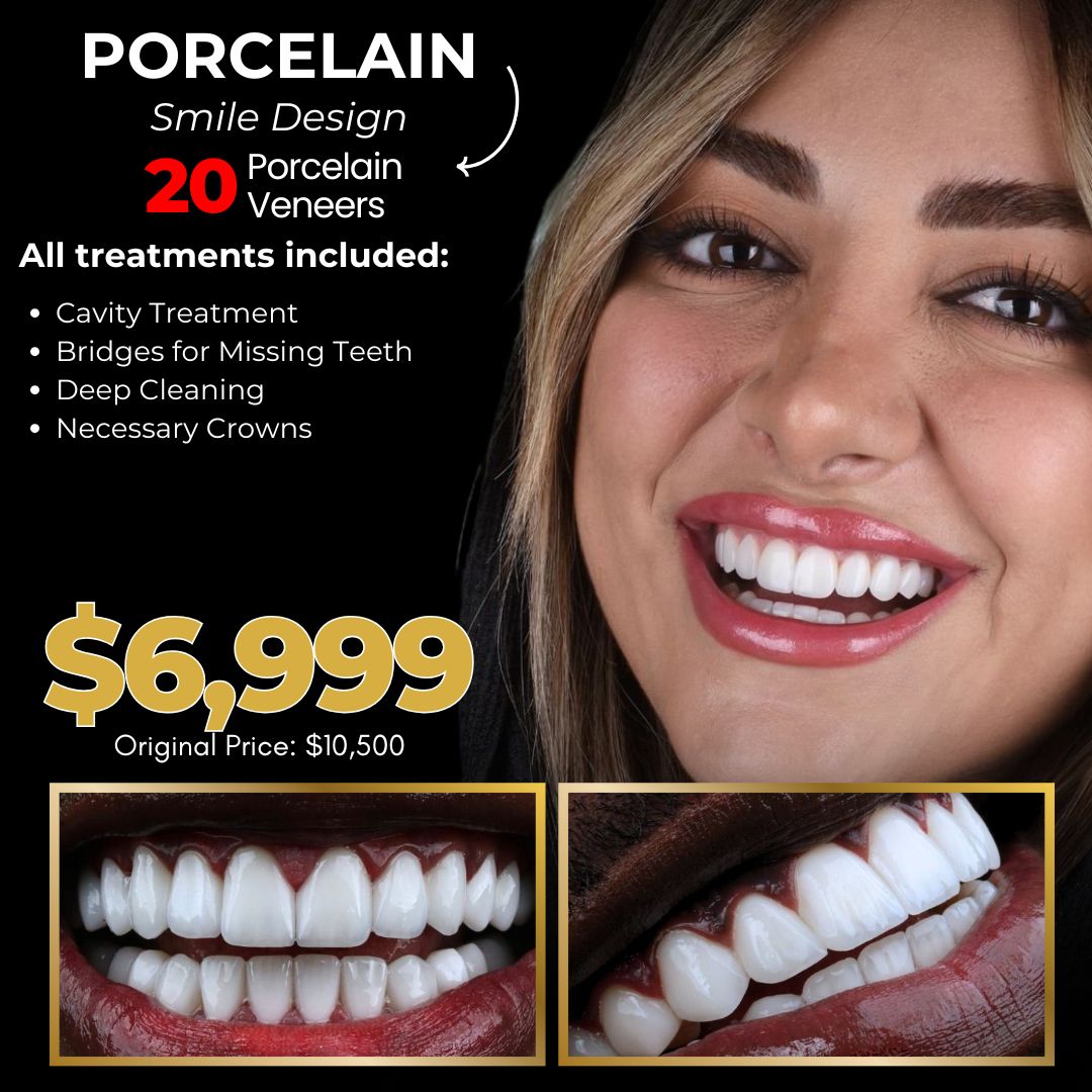 Porcelain Veneers Promo 6999