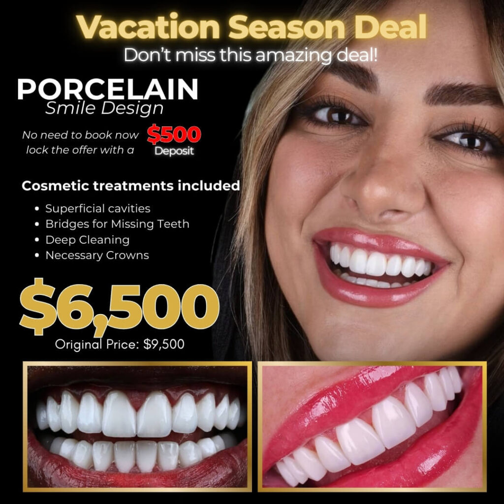 Porcelain Veneers Ads - Vacation Season Deal