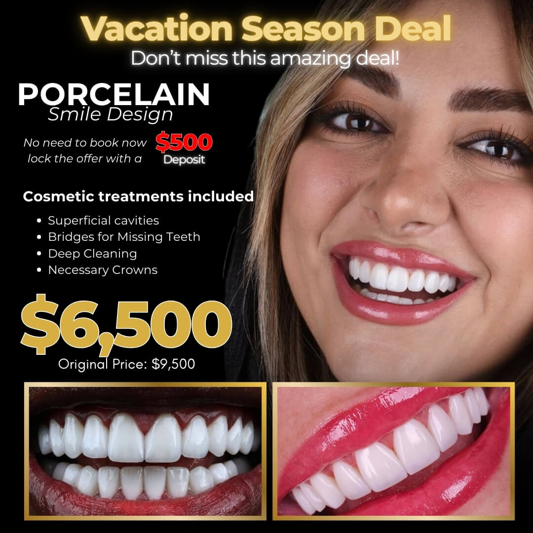Porcelain Veneers Ads - Vacation Season Deal