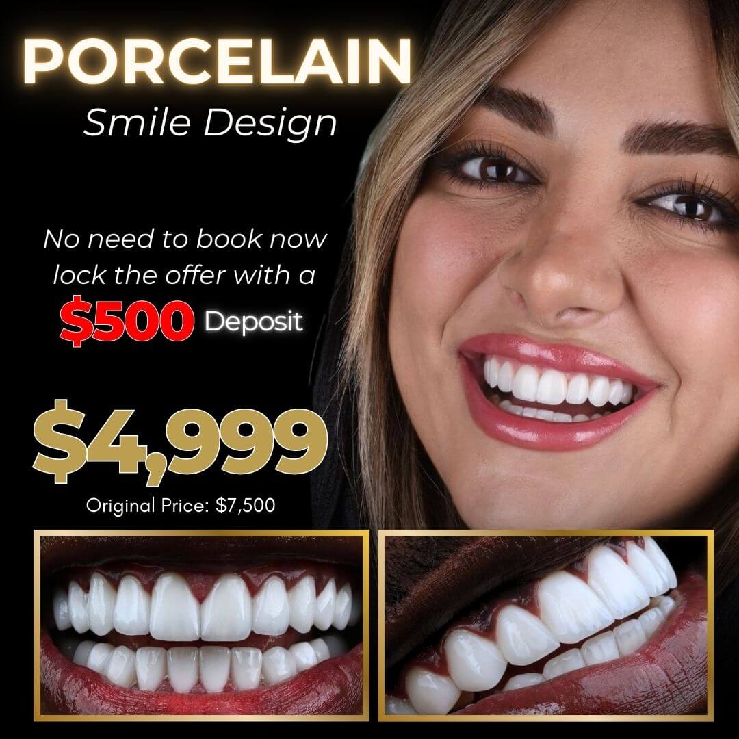 Dental Esthetic Smile - Porcelain Veneers